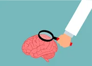 O acidente pode ocorrer por diversos motivos, como acúmulos de placas de gordura ou formação de um coágulo – que dão origem ao AVC isquêmico –, sangramento por pressão alta e até ruptura de um aneurisma – causando o AVC hemorrágico