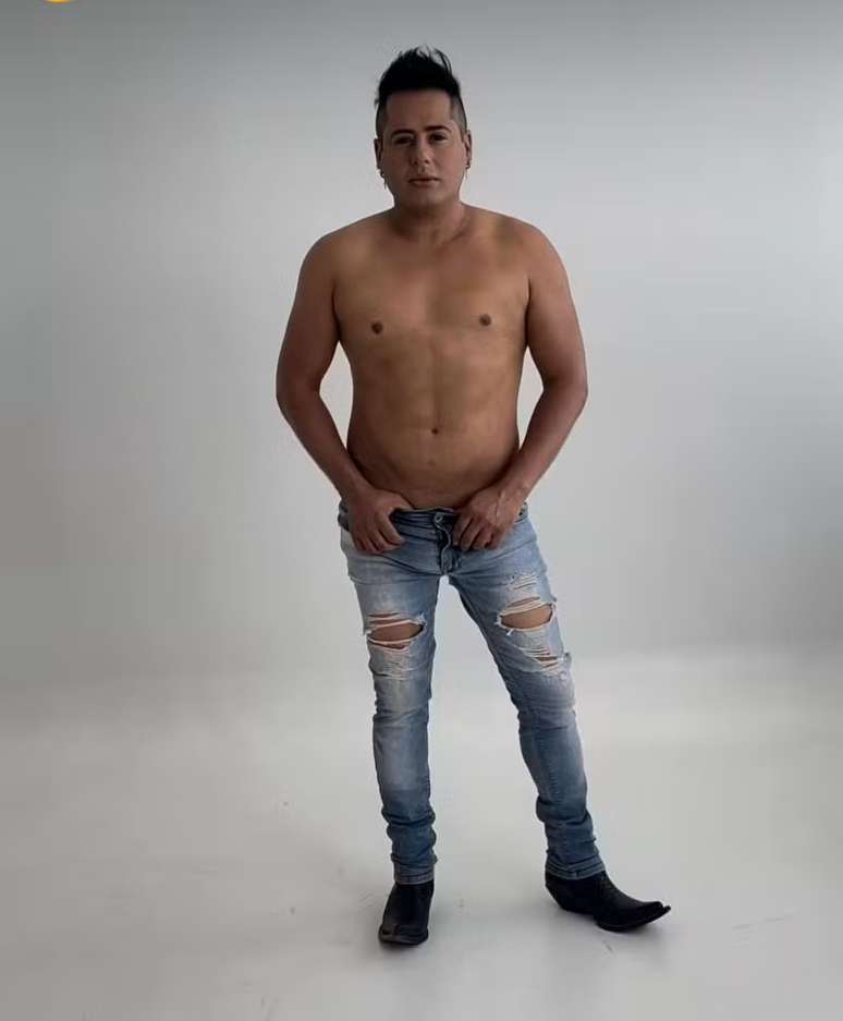 Hugo, da dupla com Tiago, mostra resultado de harmonização