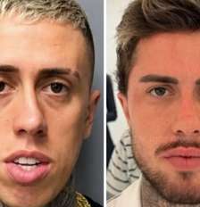 Antes e depois: MC Daniel Foto: Reprodução | Instagram